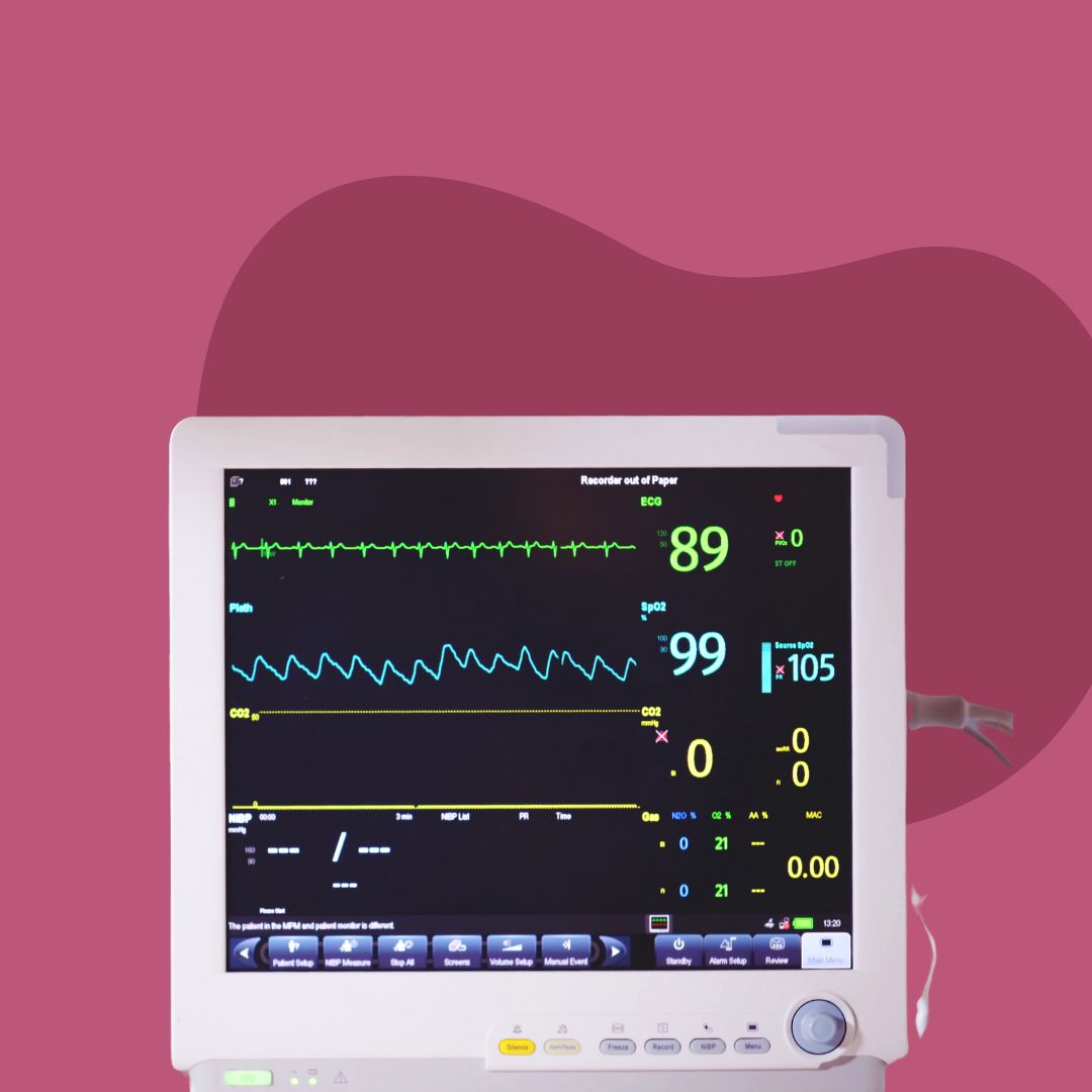 ECG