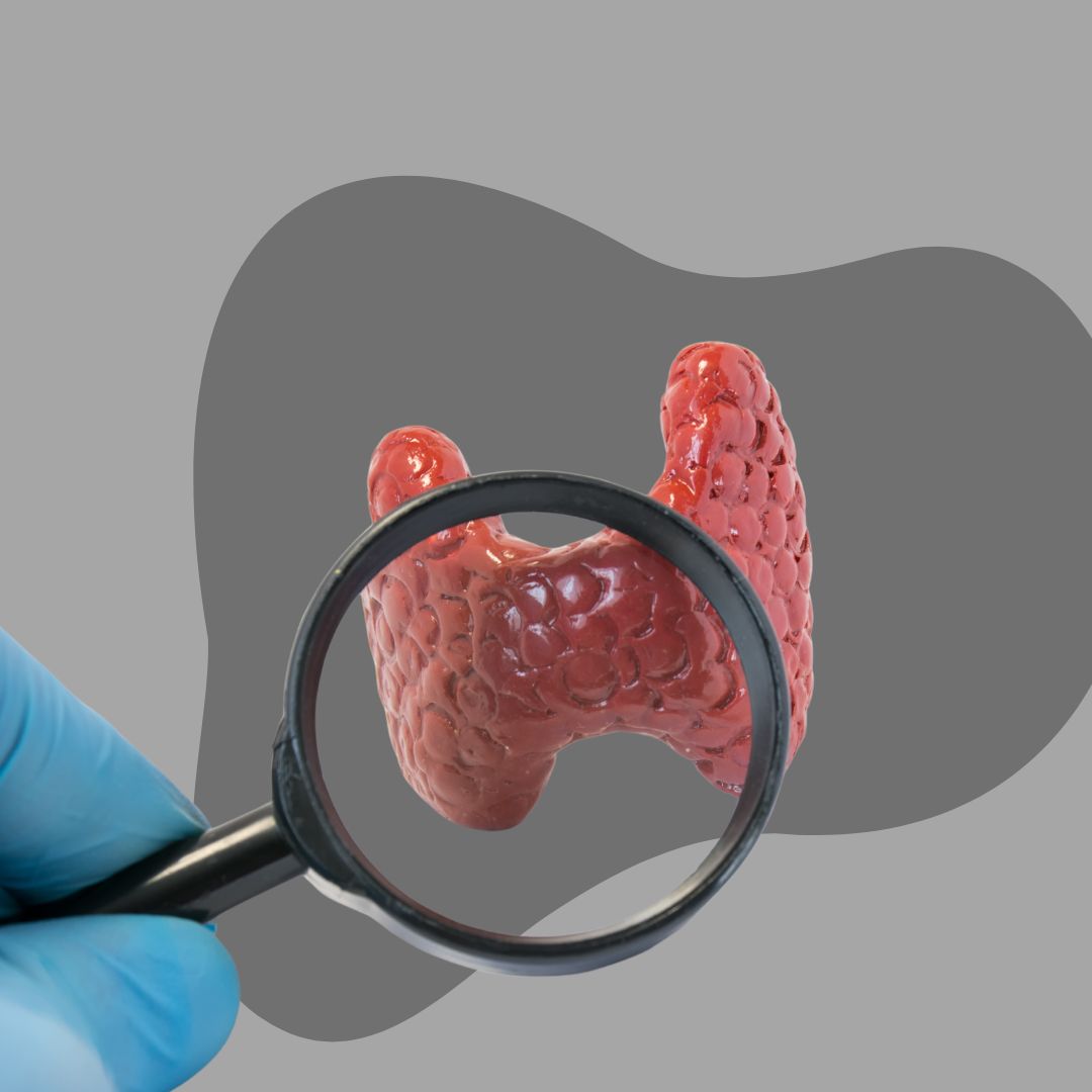 THYROID PROFILE